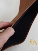 vi gap ba da be Epsom nhap khau mau xam cat (4)